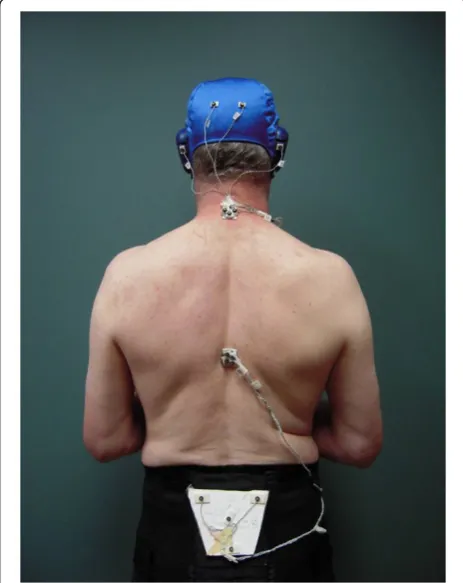Figure 2 Subject with markers attached to head, and over C7,T8 and sacrum. Note: data from head not used in present study.