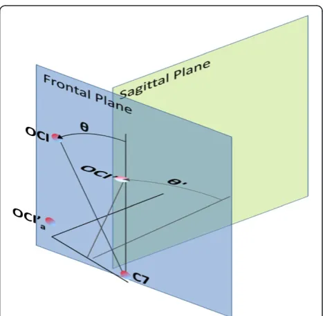 Figure 4 The projection fault occurring when NLB wascalculated in the frontal plane.