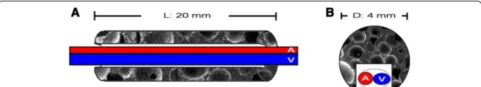 Figure 1 Schematic diagrams (A: longitudinal view; B: trasversial view) demonstrate the relationship between C-shape nHA/PA66scaffold and the implanted AV-bundle