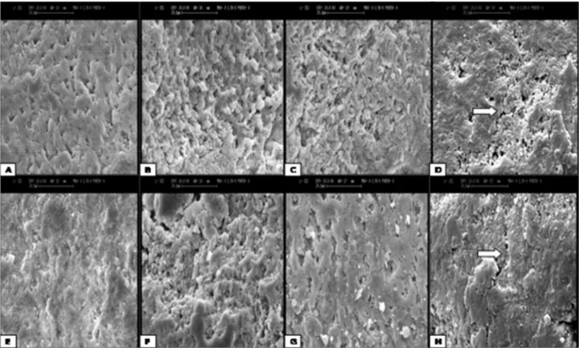   Figure 1: Scanning electron microscope images of non-fluorosed enamel surfaces (A, B, C, D) and  fluorosed enamel surfaces (E, F, G, H): A and E: acid etch for 30 seconds, B and F: acid etch for 120 seconds, C and G: air abrasion followed by acid etch, D and H: 