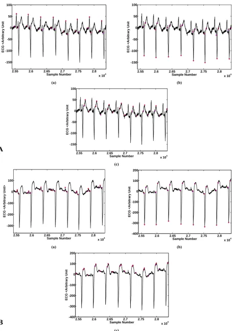 Fig. 4 An excerpted segment from a total delineated ECG. Delineated (a) P-waves, (b) QRS complexes and (c) T-waves