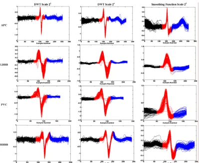 Fig.9 Features extracted via CLM for all APB, LBBB, PVC and RBBB classes of the MITDB