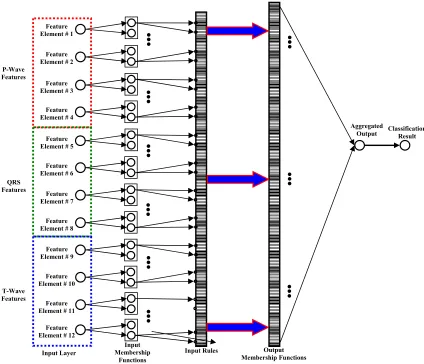 Fig. 10 The ANFIS structure used to classify four LBBB, RBBB, PVC and APB arrhythmia classes