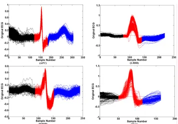 Fig. 5  Segmented beats into atrial depolarization (black), ventricular depolarization (red) and ventricular repolarization (blue) samples for arbitrary records of the MITDB including APB, LBBB, PVC and RBBB classes