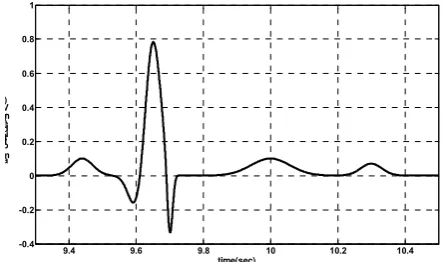 Fig. 10. Simulated normal ECG signal in lead V3  