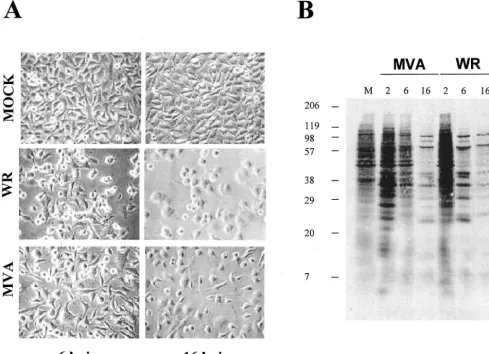 FIG. 1. Cytopathic effect and protein synthesis pattern of HeLa cells infected with VV WR and MVA strains