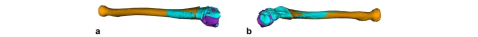 Fig. 4 Planned Correction and Residual Error. a Boxplot illustrating the planned correction and residual deformity between group I and group II,b Each osteotomy is represented by a line