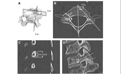 Table 1 Nomenclature for parameters measured on CT reconstruction images