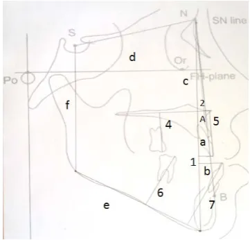 Figure 1: Cephalometric lines and angles used in this study  