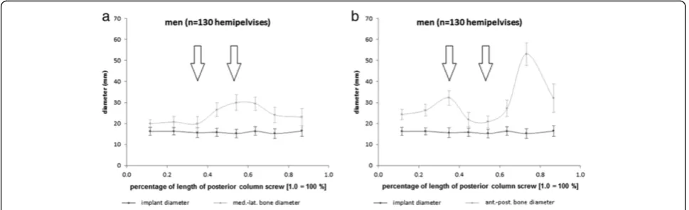 Table 6 Second constriction at the acetabulum centre. In retrograde posterior column screw placement, second constriction of theanatomically preformed bone corridor could be found at the centre of acetabulum in examined Europeans with uninjured pelvis