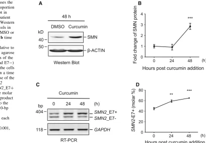 Fig. 1 Curcumin increases thelane of the gel as inc(meantranscript changes (exon 7-containingtotal of the 364- and 310-bp(in the cytoplasm, from the cellstreated with curcumin in a timecourse, andmol%) calculated as the molarintensity of the 364-bp product