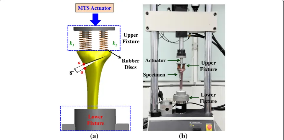 Fig. 1 Two types of the high tibial plates are placed at the three locations.TomoFix (APT)