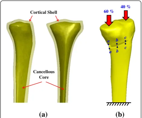 Fig. 3 a The cortical shell and cancellous core simulated in thisstudy. b During actuator movement, the compressive loads onto themedial and lateral plateaus are 60 % and 40 % of the total value,respectively
