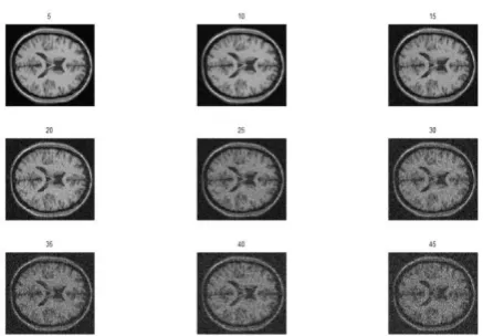 Figure 1. Image samples of several brain layers.  