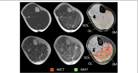 Figure 3 Relative amount of Intramuscular adipose (left) and intramuscular connective tissue (right)