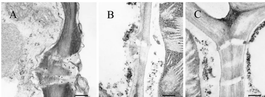 FIG. 6. Subcellular localization of Pns6 in RDV-infected leaves of O. sativa (rice). Immunogold labeling of ultrathin sections from RDV-infected (A and B) and healthy (C) rice leaves with Pns6-speciﬁc antibody is shown
