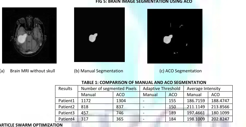 FIG 5: BRAIN IMAGE SEGMENTATION USING ACO 