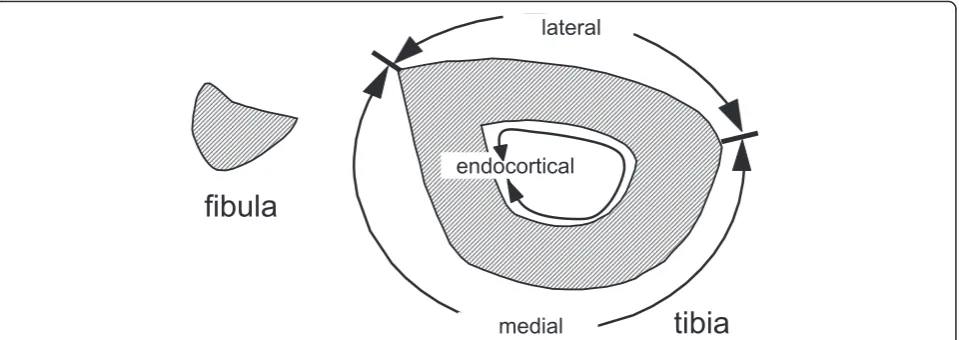 Fig. 1 Three surfaces of the tibia for histomorphometric analysis. The tibial periosteal surface was divided into lateral and medial regions asindicated for histomorphometric analysis
