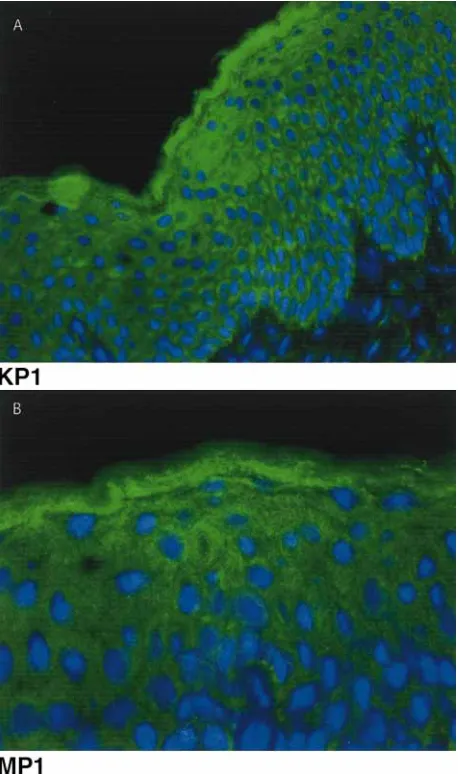 Figure 5. Inhibition of Notch-1 processing in mouse keratino-dards is shown on the left