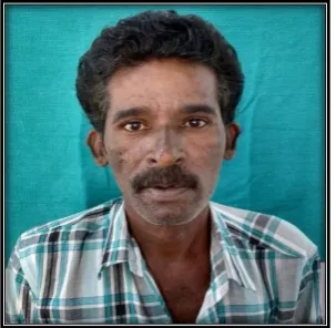 Figure 1: PRE-OPERATIVE FRONTAL VIEW 