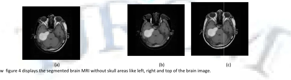 FIG 2: REMOVAL OF FILM ARTIFACTS 