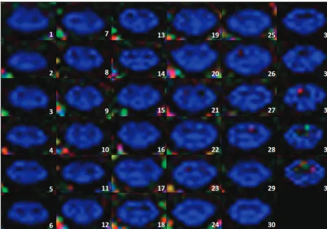 Fig 5. Axial FA color maps along the cervical spinal cord of a control subject (35 sections)