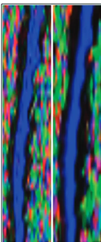 Fig 6. Midline sagittal FA color maps of a representative cervical spinal cord pre- (left) andpost- (right) image registration