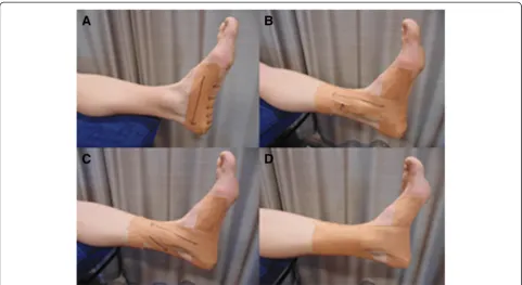 Figure 4 Rigid anti-pronation taping technique (ALD). The ALD technique will be applied following guidelines previously described [25].The ALD comprises of a low-Dye technique (A) with the addition of three reverse-6 techniques (B) and two calcaneal sling 