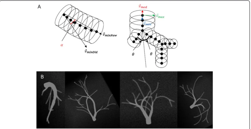 Figure 1 Generation of digital vessel model. (A) Geometrical construction, (B) examples of different vessel tree models.