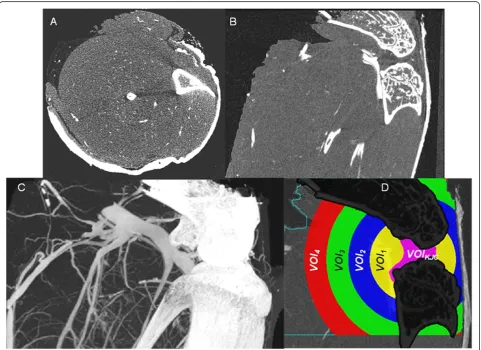 Figure 4 μCT images of a knee joint of a non-arthritic mouse perfused with lead containing contrast agent