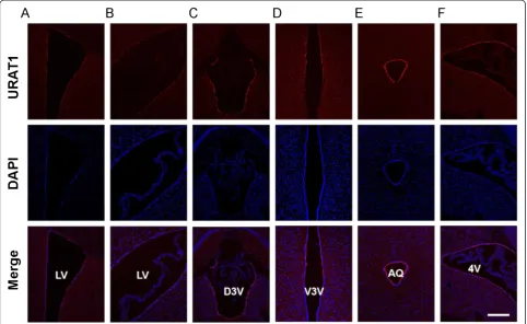 Figure 2 Expression levels of URAT1 differ between ventricles. (A–F) Frozen coronal sections from nine-week-old WT mice were stainedwith anti-URAT1 (red) and DAPI (blue) and imaged by confocal microscopy