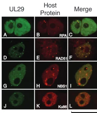 TABLE 1. Colocalization of UL29a