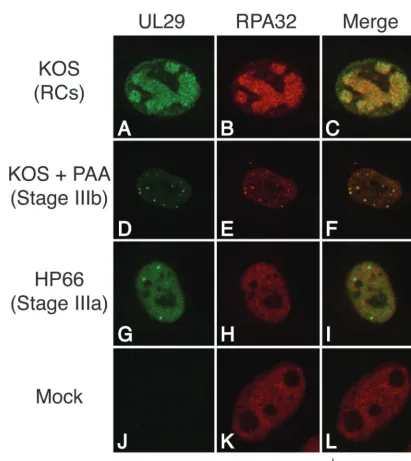 FIG. 2. RPA 32-kDa subunit colocalizes with UL29 in replication compartments (RCs) and stage IIIb foci but not stage IIIa foci