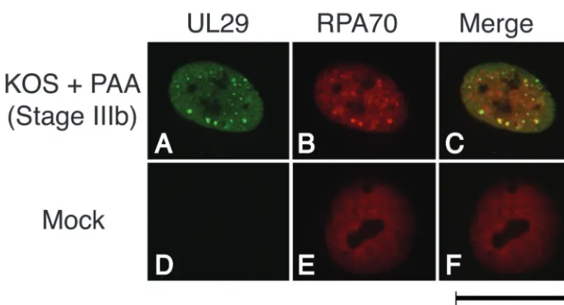 FIG. 3. RPA 70-kDa subunit colocalizes with UL29 in stage IIIb prereplicative sites of HSV-1-infected cells