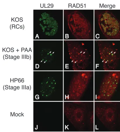 FIG. 4. RAD51 colocalizes predominantly with UL29 in replication compartments (RCs) and stage IIIb foci but not stage IIIa foci