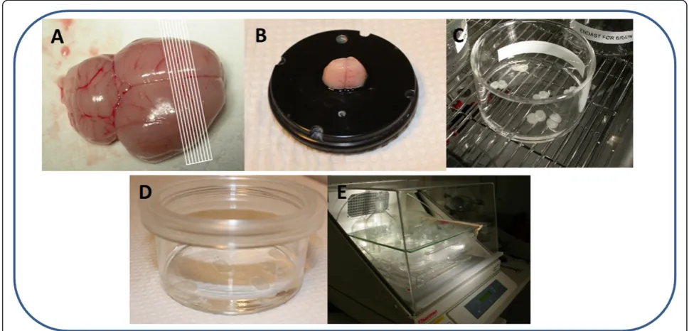 Figure 1 The main steps in the preparation of brain slices. A. Schematic representation of the cutting directions