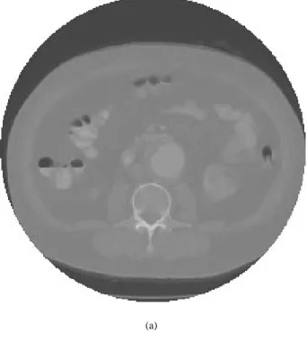 Figure 8: Examples of a single CT slice (note that printed colours do not match exactly the colours shown on the monitor): (a) the slice dis- dis-played using a greyscale intensity ramp; (b) colours from the original seven-colour experiment, although the l