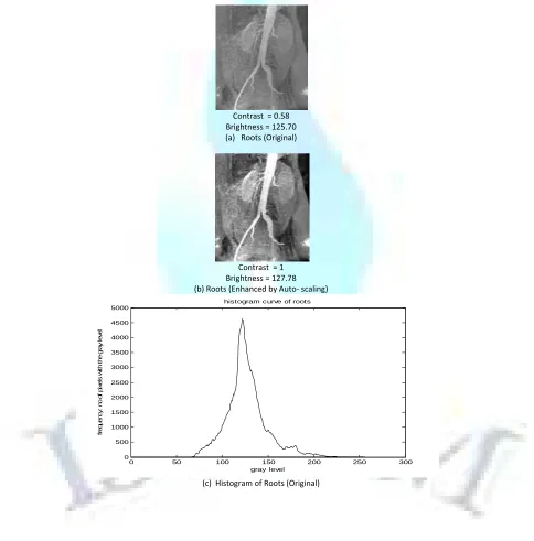 FIG. 3: HISTOGRAM PROCESSING 