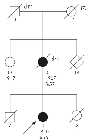 Figure 3. Patient with ovarian cancer and detected 5382insC BRCA1 mutation from family with negative family history