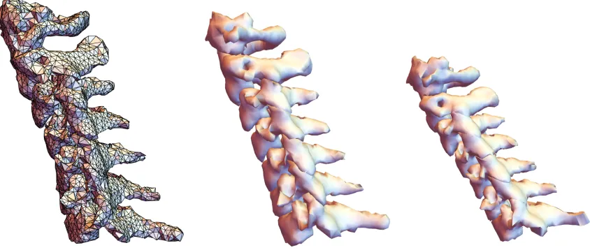 Figure 7. Example spine meshes obtained from CT scans of supine patients. The image on the left shows the individual polygons
