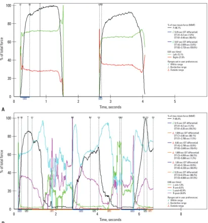 Fig. 4. Force distribution on right and left sides before BTX-A injection (A) and 12 weeks thereafter (B)