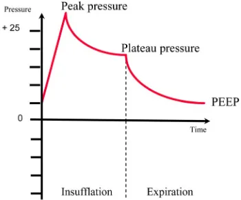 Table 1. Criteria for protective mechanical ventilation. 