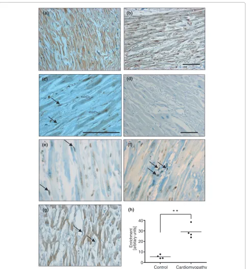 Figure 5 The p53-NF-κB complex is present at the GIS regulatory region in human dilated cardiomyopathic heartsantibody control