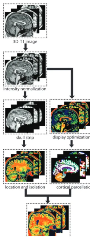 Fig 1. Pipeline of LGN isolation on a 3D T1-weighted image. The procedure mainly includedintensity nonuniformity correction, gray-level normalization, color-mapping highlighting,cerebral cortex parcellation, landmark identification, and LGN localization and refinement.