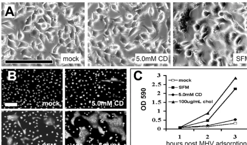 FIG. 4. Distribution of CEACAMs after cell fractionation in 1%TX-100-containing sucrose gradients