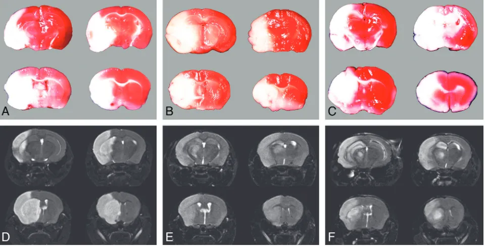 Fig 4. Brain TTC staining and the corresponding T2-weighted images in groups IV (A, D), VI (B, E), and IX (C, F) show that the infarct location and size are well matched.
