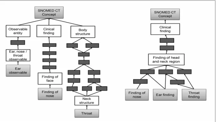 Fig. 4  Left: Illustration of how the expressions, ear, nose and throat can be represented by SNOMED CT without considering the sufficient hierarchy  and concept selection