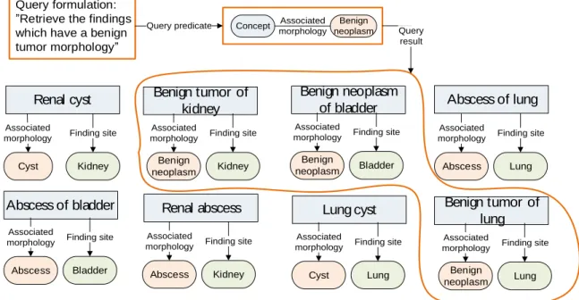 Figure 6-2: Query to retrieve benign neoplasm findings 