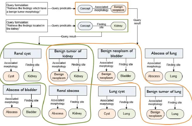 Figure 6-4: Query to retrieve benign neoplasms of the kidney 