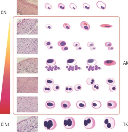 Table 1. Best-Fit Model Selection to Calculate Cut-Off Values between Biopsy Scores of [(0) and (1, 2)], and [(0, 1) and (2)], Based on the Lowest AIC and the Highest OR